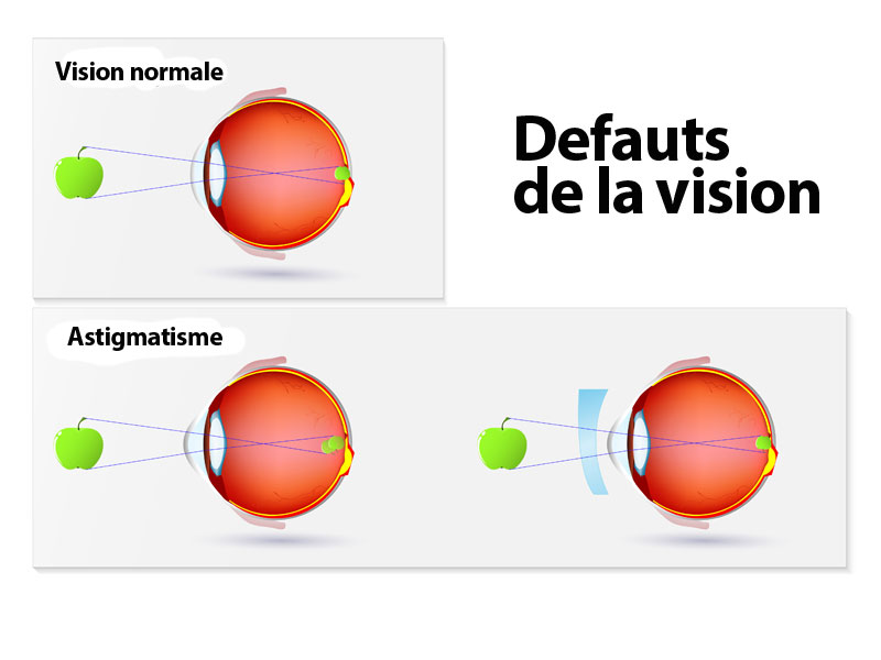 01_Oeiletlavision_fillesdyeux_centre_ophtalmologie_Tournai